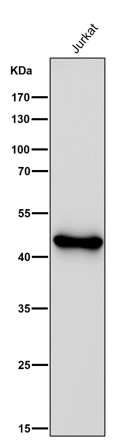 1 - Anti-FOXP3 Rabbit Monoclonal Antibody ABO15153