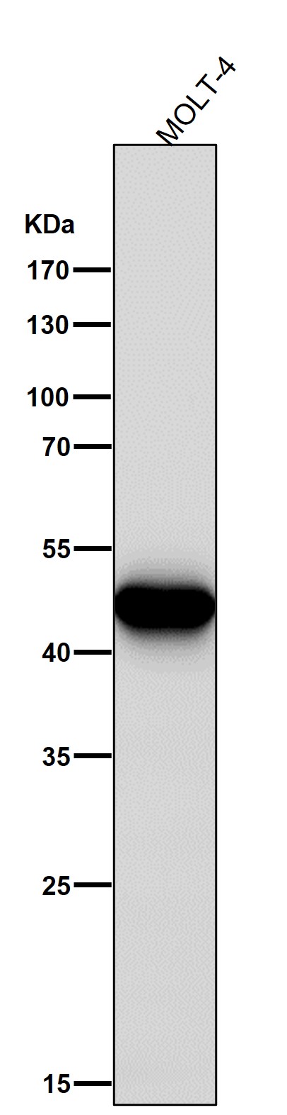 1 - Anti-FOXP3 Rabbit Monoclonal Antibody ABO15153