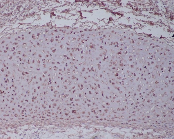 2 - Anti-Aggrecan Rabbit Monoclonal Antibody ABO15157