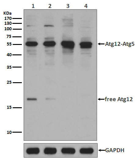 1 - Anti-Apg12(Atg12) Rabbit Monoclonal Antibody ABO15158
