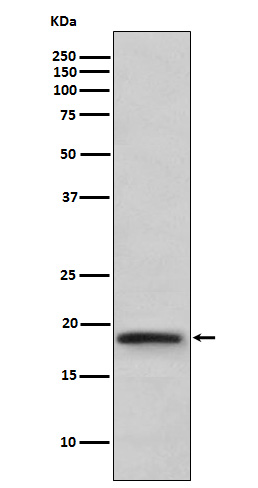1 - Anti-TNF beta Rabbit Monoclonal Antibody ABO15160