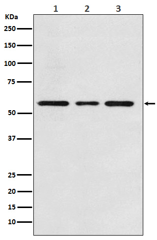 1 - Anti-ACVRL1 Rabbit Monoclonal Antibody ABO15161