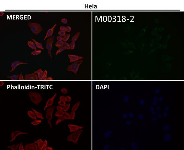 1 - Anti-PI3 Kinase p85 alpha Rabbit Monoclonal Antibody ABO15162