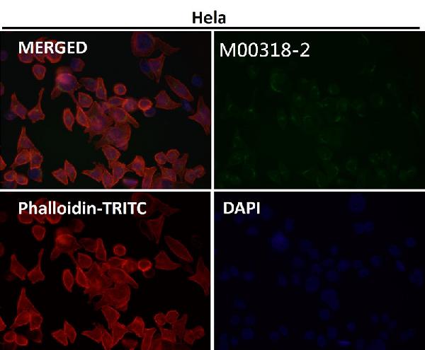 1 - Anti-PI3 Kinase p85 alpha Rabbit Monoclonal Antibody ABO15162