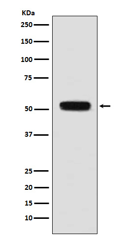 1 - Anti-Fibulin 5 Rabbit Monoclonal Antibody ABO15163