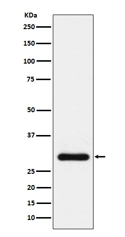 1 - Anti-BNP Rabbit Monoclonal Antibody ABO15166