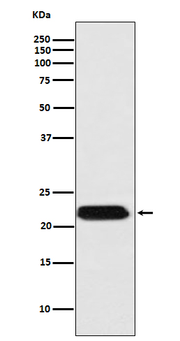 1 - Anti-FTMT Rabbit Monoclonal Antibody ABO15173