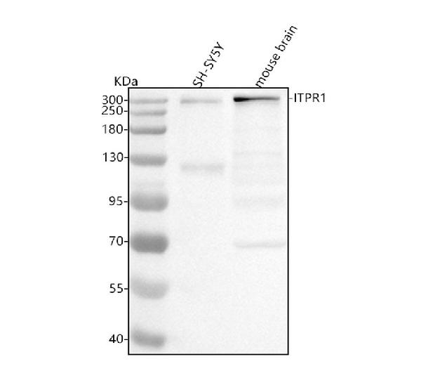 1 - Anti-IP3 Receptor Rabbit Monoclonal Antibody ABO15174