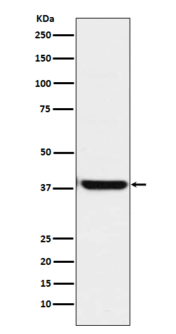 1 - Anti-OGG1 Rabbit Monoclonal Antibody ABO15176