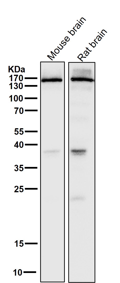 1 - Anti-NMDAR2A Rabbit Monoclonal Antibody ABO15177