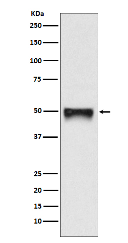 1 - Anti-CD209 Rabbit Monoclonal Antibody ABO15178