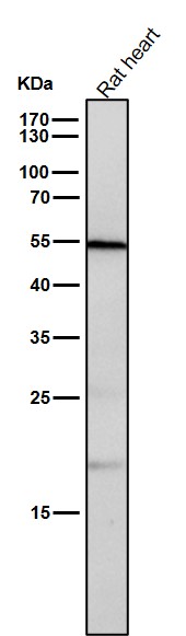 1 - Anti-CD209 Rabbit Monoclonal Antibody ABO15178