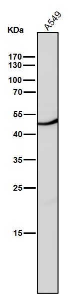 1 - Anti-CD209 Rabbit Monoclonal Antibody ABO15178