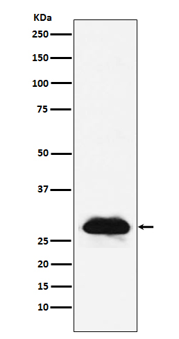 1 - Anti-Carbonic anhydrase 2 Rabbit Monoclonal Antibody ABO15179