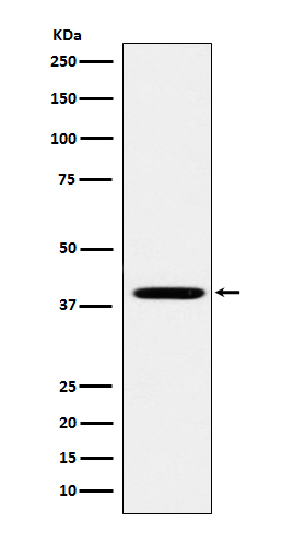 1 - Anti-FOLR1 Rabbit Monoclonal Antibody ABO15183