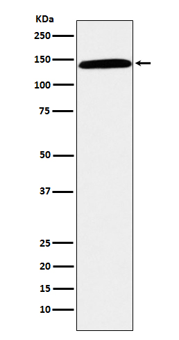 1 - Anti-CD42b Rabbit Monoclonal Antibody ABO15184