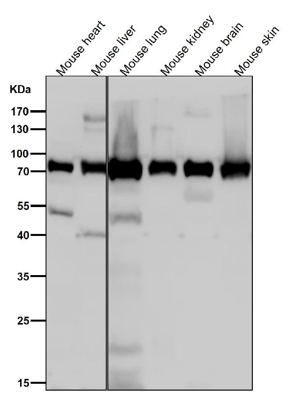 1 - Anti-Calpain 2 Rabbit Monoclonal Antibody ABO15186