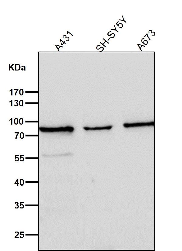1 - Anti-Calpain 2 Rabbit Monoclonal Antibody ABO15186