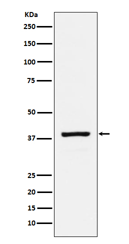 1 - Anti-RASSF1 Rabbit Monoclonal Antibody ABO15187
