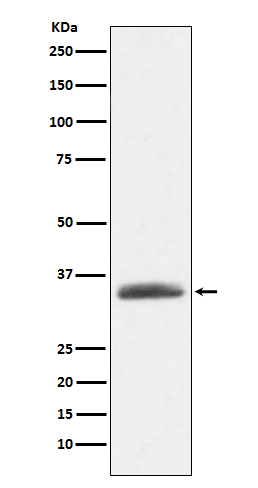 1 - Anti-AMBP Rabbit Monoclonal Antibody ABO15188