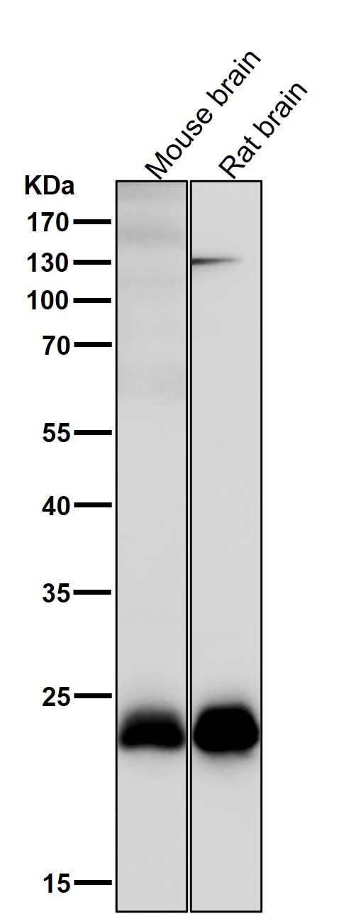 1 - Anti-SNAP23 Rabbit Monoclonal Antibody ABO15191