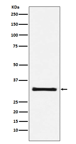 1 - Anti-GC1q R Rabbit Monoclonal Antibody ABO15193