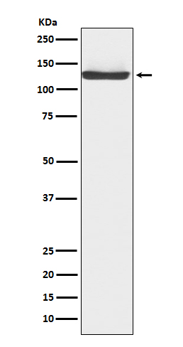 1 - Anti-JAK3 Rabbit Monoclonal Antibody ABO15195
