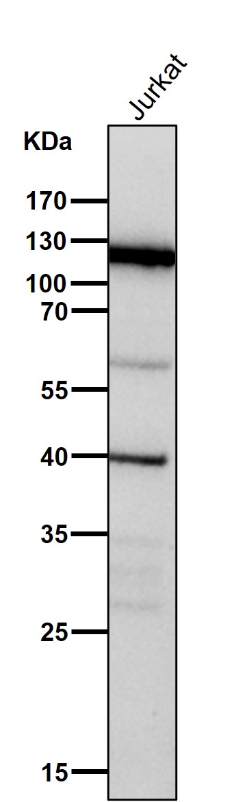 1 - Anti-JAK3 Rabbit Monoclonal Antibody ABO15195