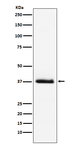 1 - Anti-Parathyroid Hormone Rabbit Monoclonal Antibody ABO15196