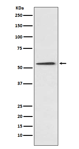 1 - Anti-Protein C Rabbit Monoclonal Antibody ABO15197