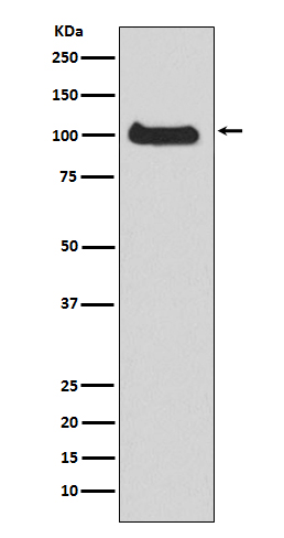 1 - Anti-PKC mu Rabbit Monoclonal Antibody ABO15198