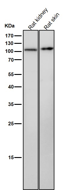 1 - Anti-PKC mu Rabbit Monoclonal Antibody ABO15198
