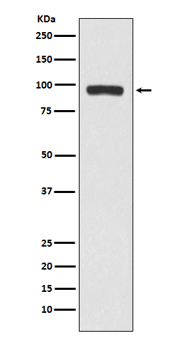 1 - Anti-BCHE Rabbit Monoclonal Antibody ABO15199