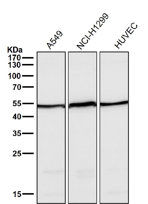 1 - Anti-Angiopoietin 2 Rabbit Monoclonal Antibody ABO15201