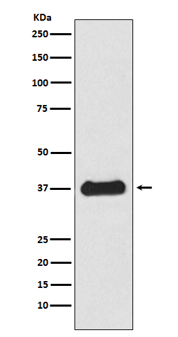 1 - Anti-Follistatin Rabbit Monoclonal Antibody ABO15203