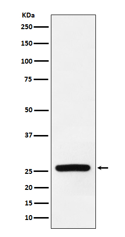 1 - Anti-Superoxide Dismutase 3 Rabbit Monoclonal Antibody ABO15205
