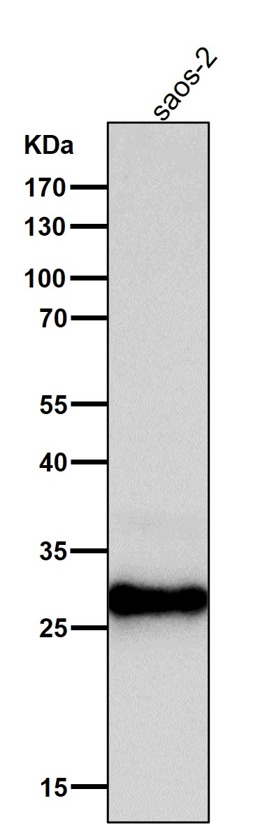 1 - Anti-Superoxide Dismutase 3 Rabbit Monoclonal Antibody ABO15205