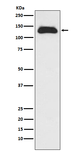 1 - Anti-Eg5 Rabbit Monoclonal Antibody ABO15207