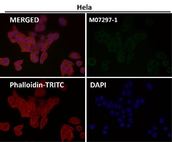 1 - Anti-GABA B Receptor 1 Rabbit Monoclonal Antibody ABO15208