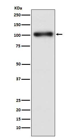 1 - Anti-GABA B Receptor 1 Rabbit Monoclonal Antibody ABO15208