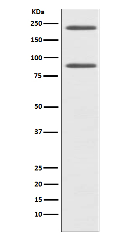 1 - Anti-C4 Rabbit Monoclonal Antibody ABO15209