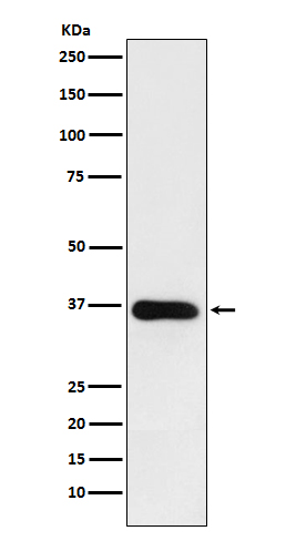 1 - Anti-HSD11B1 Rabbit Monoclonal Antibody ABO15210