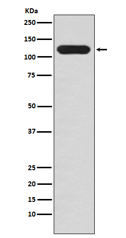 1 - Anti-MUC4 Rabbit Monoclonal Antibody ABO15213