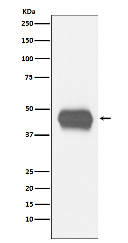 1 - Anti-CD1a Rabbit Monoclonal Antibody ABO15215