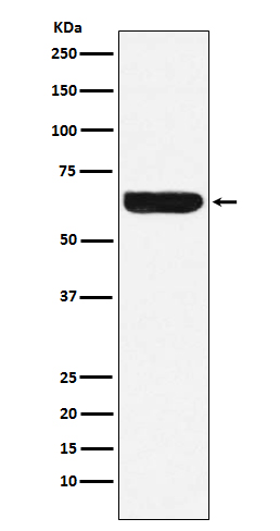 1 - Anti-Placental alkaline phosphatase (PLAP) Rabbit Monoclonal Antibody ABO15217