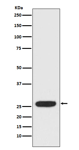 1 - Anti-StAR Rabbit Monoclonal Antibody ABO15218