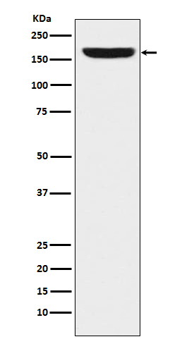 1 - Anti-REST / NRSF Rabbit Monoclonal Antibody ABO15219