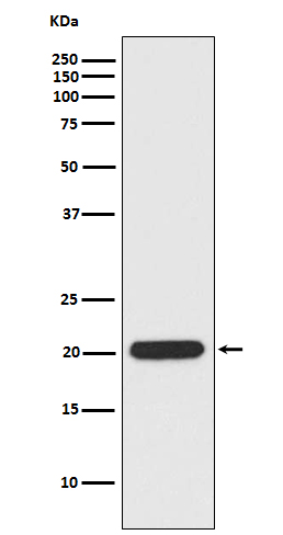 1 - Anti-Ferritin Heavy Chain Rabbit Monoclonal Antibody ABO15220
