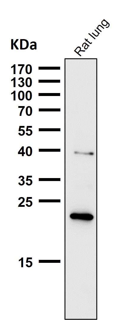 1 - Anti-Ferritin Heavy Chain Rabbit Monoclonal Antibody ABO15220