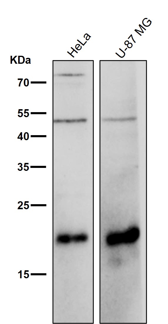 1 - Anti-Ferritin Heavy Chain Rabbit Monoclonal Antibody ABO15220